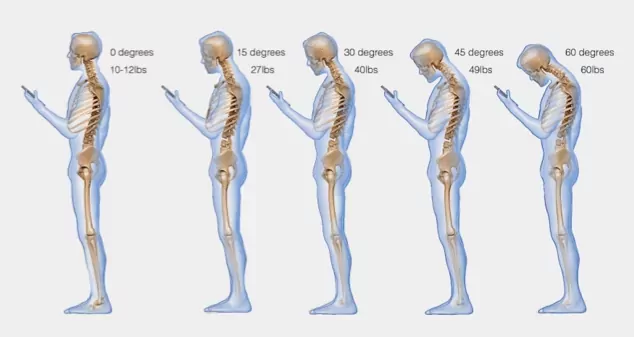 What Is Your Head Position Doing To Your Spine?