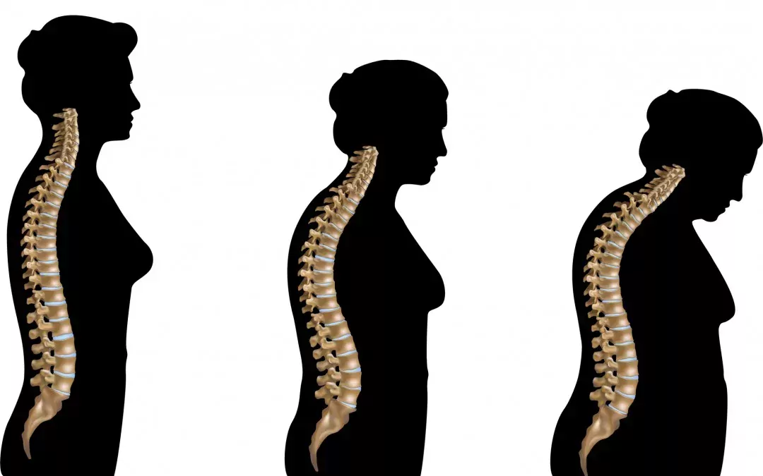 What is Osteoporosis?