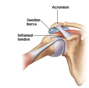 Shoulder Pain & Posture & How They’re Connected